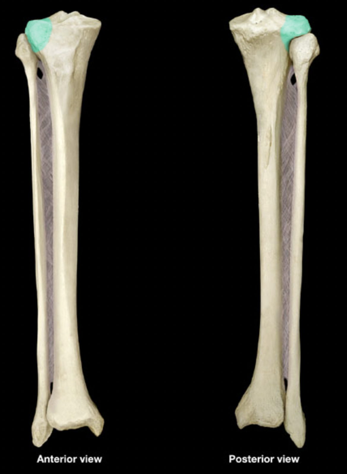 <p>of tibia</p>