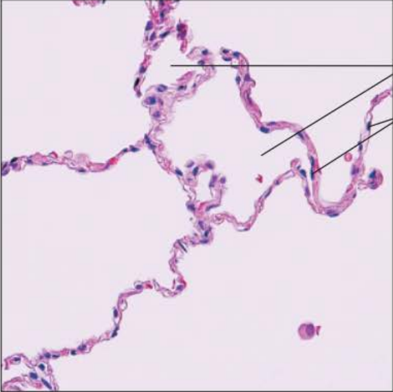 <p>Identify this tissue</p><p></p><p>Name a function</p><p></p><p>Name a specific place where it is found</p>