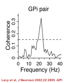 <p>In Parkinson's disease, the discharge of neurons becomes excessively synchronized, leading to abnormal motor control.</p><p>Synchronization between pairs of neurons occurs in two principal frequency bands within the basal ganglia of parkinsonian animals and patients:</p><p><strong>Low frequencies</strong>, possibly related to tremor (more prominent in MPTP-induced monkeys).</p><p><strong>13-30 Hz (beta band)</strong>, which is often associated with motor dysfunction in Parkinson’s disease.</p>