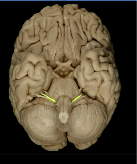 <p>Location of facial nerves?</p>