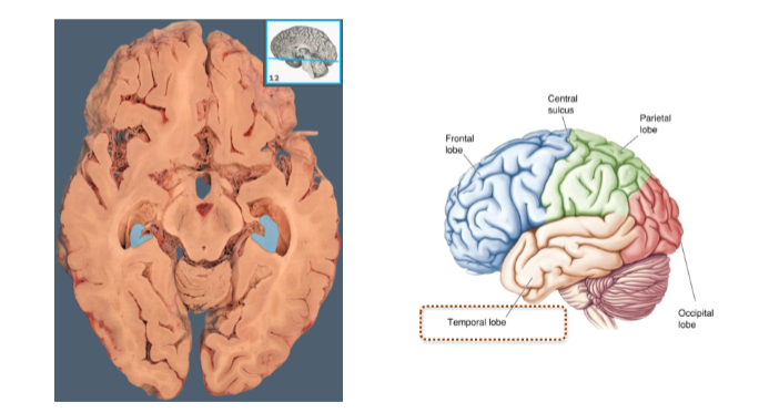 <p>Important regions within the <strong>forebrain</strong>.</p><p>Various <strong>sub-cortical structures</strong>, such as the <strong>hippocampus</strong>.</p>