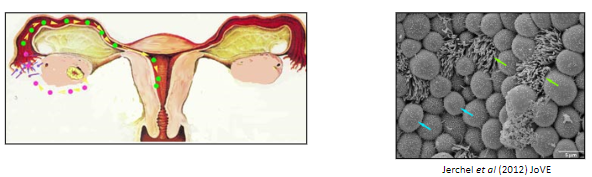 <p>The <strong>oocyte with cumulus cells</strong> is extruded from the ovary.</p><p><strong>Follicular fluid</strong> may flow into the Pouch of Douglas.</p><p>The egg is <strong>collected by the fimbriae</strong> of the uterine (Fallopian) tube.</p><p>The egg progresses down the tube via <strong>peristalsis</strong> and the action of <strong>cilia</strong>.</p>