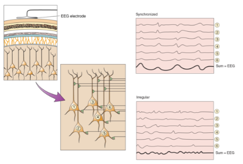 <p>The amplitude of an EEG signal depends on how synchronous the activity of a group of cells is.</p>