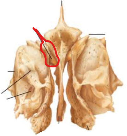 <p>Cribriform plate</p>