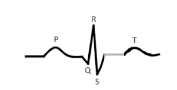 <p>what is this?</p><p>Period where the entire ________ system is depolarized</p>