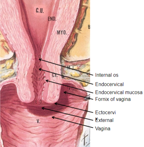 <p><strong>Muscular structure:</strong> The cervix is a muscular organ capable of significant expansion during childbirth.</p><p><strong>Endocervical mucosa:</strong> About 3mm thick, it is lined with columnar mucous cells and contains numerous tubular mucous glands that secrete viscous, alkaline mucus into the lumen, providing a protective barrier against infections.</p><p><strong>Function as a barrier:</strong> The mucus prevents pathogens from entering the uterus but still allows passage of motile sperm.</p><p><strong>Ectocervix:</strong> Covered with nonkeratinized stratified squamous epithelium, similar to the vaginal lining, providing further protection.</p>