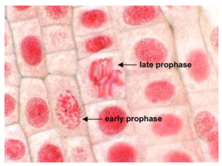 <p>Prophase </p>