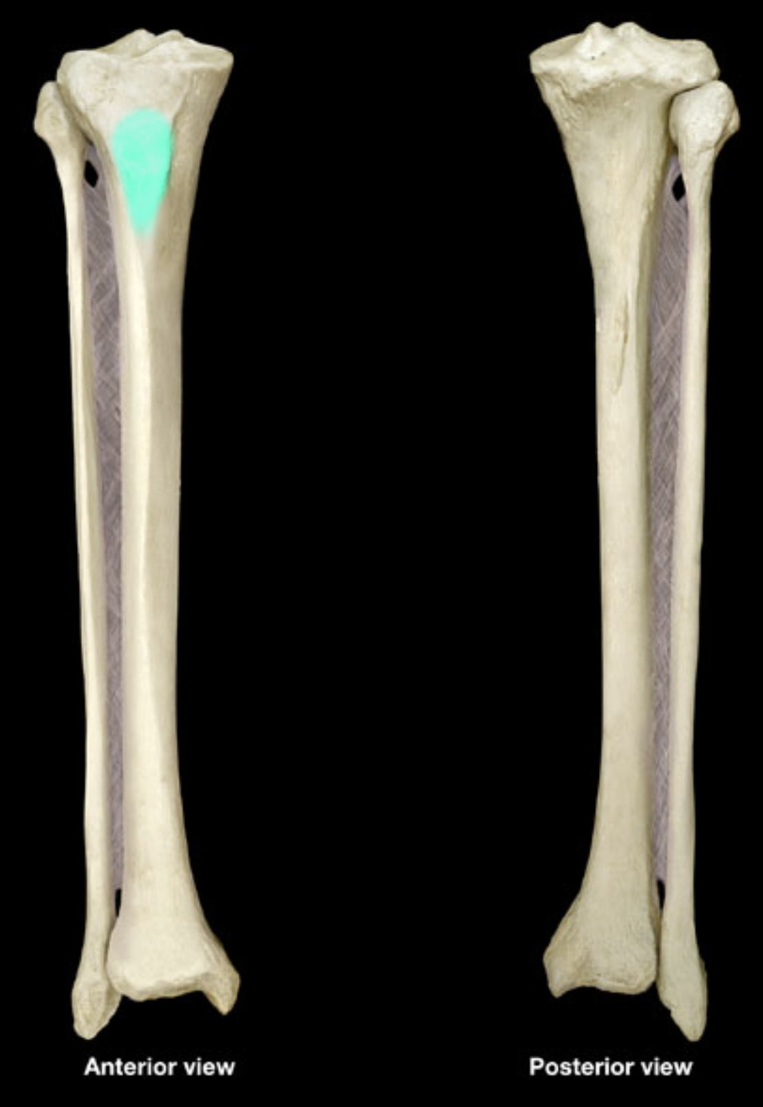 <p>of tibia</p>