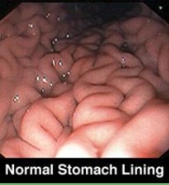 <p>Features of the Stomach</p>