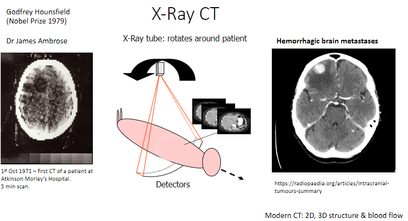 <p>Invented the X-ray computed tomography (CT) scan.</p><p>Won the Nobel Prize in Physiology or Medicine in 1979.</p>