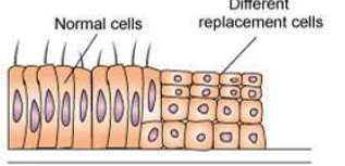 <p>What kind of cellular changes are occurring in the picture?</p>