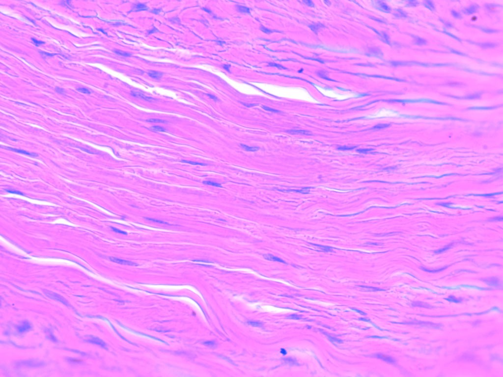 <p>Many <span class="tt-bg-yellow">collagen fibres packed </span>together with <span class="tt-bg-yellow">fibroblasts</span> in between which <span class="tt-bg-yellow">resists tension</span></p>