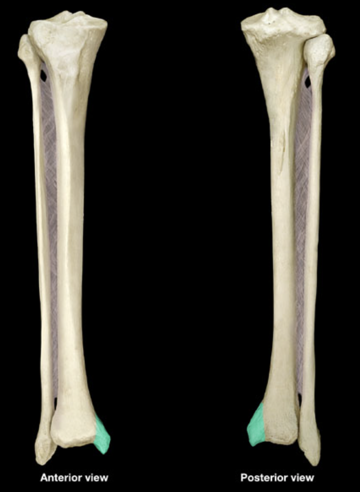 <p>of tibia</p>