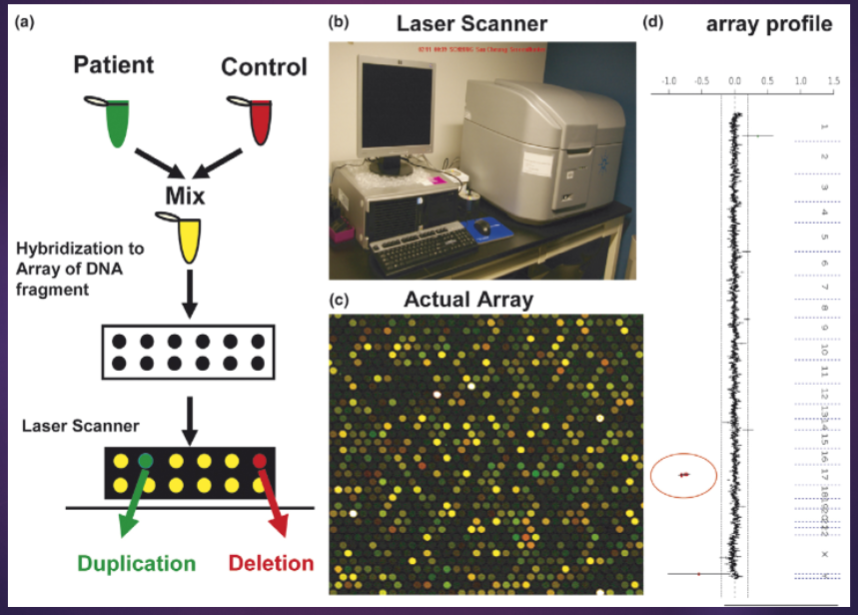 <p>aCGH is a molecular cytogenetic technique used to detect and quantify genomic copy number variations (CNVs) across the genome.</p><p>It involves comparing labeled DNA from a test sample to a reference sample, allowing for the identification of deletions, duplications, and other structural variations.</p><p>Key applications of aCGH include cancer research, prenatal testing, and the study of genetic disorders, providing insights into genomic imbalances associated with various diseases.</p>