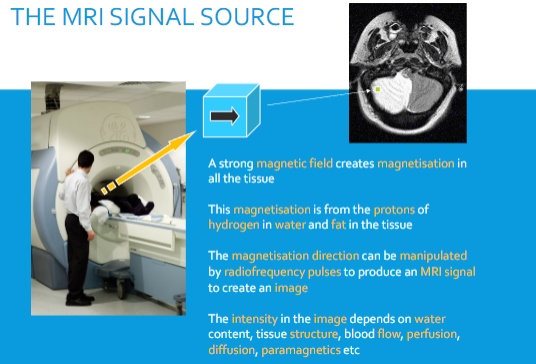 <p>Water content.</p><p>Tissue structure.</p><p>Blood flow.</p><p>Perfusion.</p><p>Diffusion.</p><p>Presence of paramagnetic substances.</p>