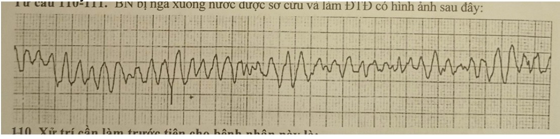 <p>Từ câu 110-111. BN bị ngã xuống nước được sơ cứu và làm ĐTĐ có hình ảnh sau dây: </p><p></p><p>110. Xử trí cần làm trước tiên cho bệnh nhân này là: </p><p>A Sôc diên B. Đặt nội khí quan C. Tiêm xylocain D.Tiêm adrenalin</p>