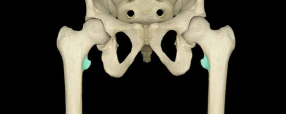 <p>of femur</p>