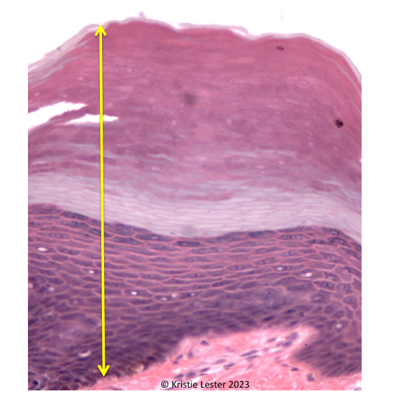 <p>What type of tissue is this? Where in the body could you find this tissue type?</p>