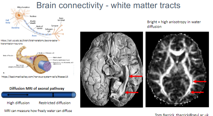 <p><strong>Water diffusion</strong> within the axonal pathways of white matter.</p><p>The degree of <strong>restricted or free diffusion</strong> of water, which helps assess brain connectivity.</p>