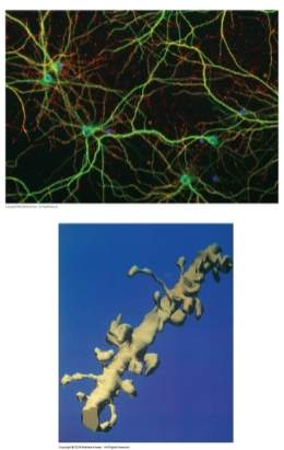 <p>Dendritic spines are small sacs of membrane that protrude from the dendrites of some cells.</p><p>They receive synaptic input and play a crucial role in synaptic signaling.</p>