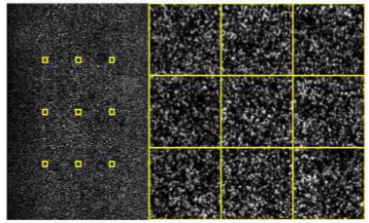 <p><strong>Camera Imaging</strong>: A camera captures images of the four bases on the surface of the flow cell after each cycle.</p><p><strong>Fluorescent Colors</strong>: Each base emits a distinct fluorescent signal, allowing identification of the incorporated nucleotide.</p><p><strong>Conversion</strong>: Each cycle's image is converted into a nucleotide base call (A, C, G, or T).</p>