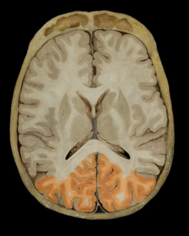 <p>Where is the Occipital Lobe located?</p>