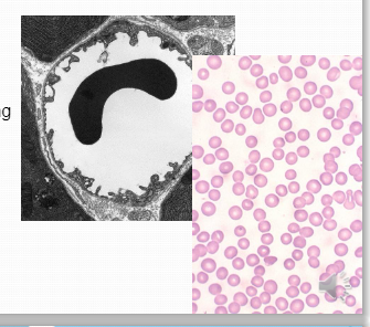 Erythrocyte (red blood cells) 