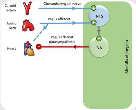 <p>-Loading of the baroreceptors (stretching or deformation due to changes in blood pressure) stimulates the vagus nerve, activating the Nucleus Tractus Solitarius (NTS)</p><p>-The signal from the NTS stimulates the nucleus ambiguous (vagal nuclei)</p><p>-Vagal parasympathetic impulses are sent to the heart, exerting a depressor effect (a sustained and long-lasting increase in blood pressure resulting from an increase in peripheral vascular resistance)</p>