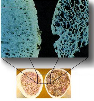 <p>Endocrine disorders</p><p>Malignancy</p><p>Drug-induced factors</p><p>Renal disease</p><p>Nutritional deficiencies</p><p>Age</p>