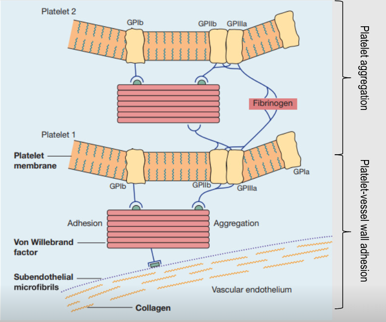 <p>1)<span class="tt-bg-red">Immobilization of platelets</span> at site of injury requiring platelet-vessel wall adhesion.</p><p>2)<span class="tt-bg-red">vWF</span> derived from endothelial cells <span class="tt-bg-red">connects platelet tosubendothelial</span> through <span class="tt-bg-green">GPIb receptor</span>.</p><p>3)<span class="tt-bg-red">additional platelets</span> from the circulating blood are drawn to the area of injury</p><p>4)<span class="tt-bg-red">continuous platelet aggregation</span> promotes the growth of thehaemostatic plug, which soon covers the exposed connectivetissue</p><p>5)<span class="tt-bg-red">unstable</span> primary haemostatic plug temporarily controls bleeding</p>