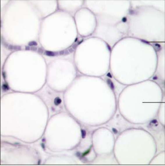 <p>Identify this tissue</p><p></p><p>Name a function</p><p></p><p>Name a specific place where it is found</p>