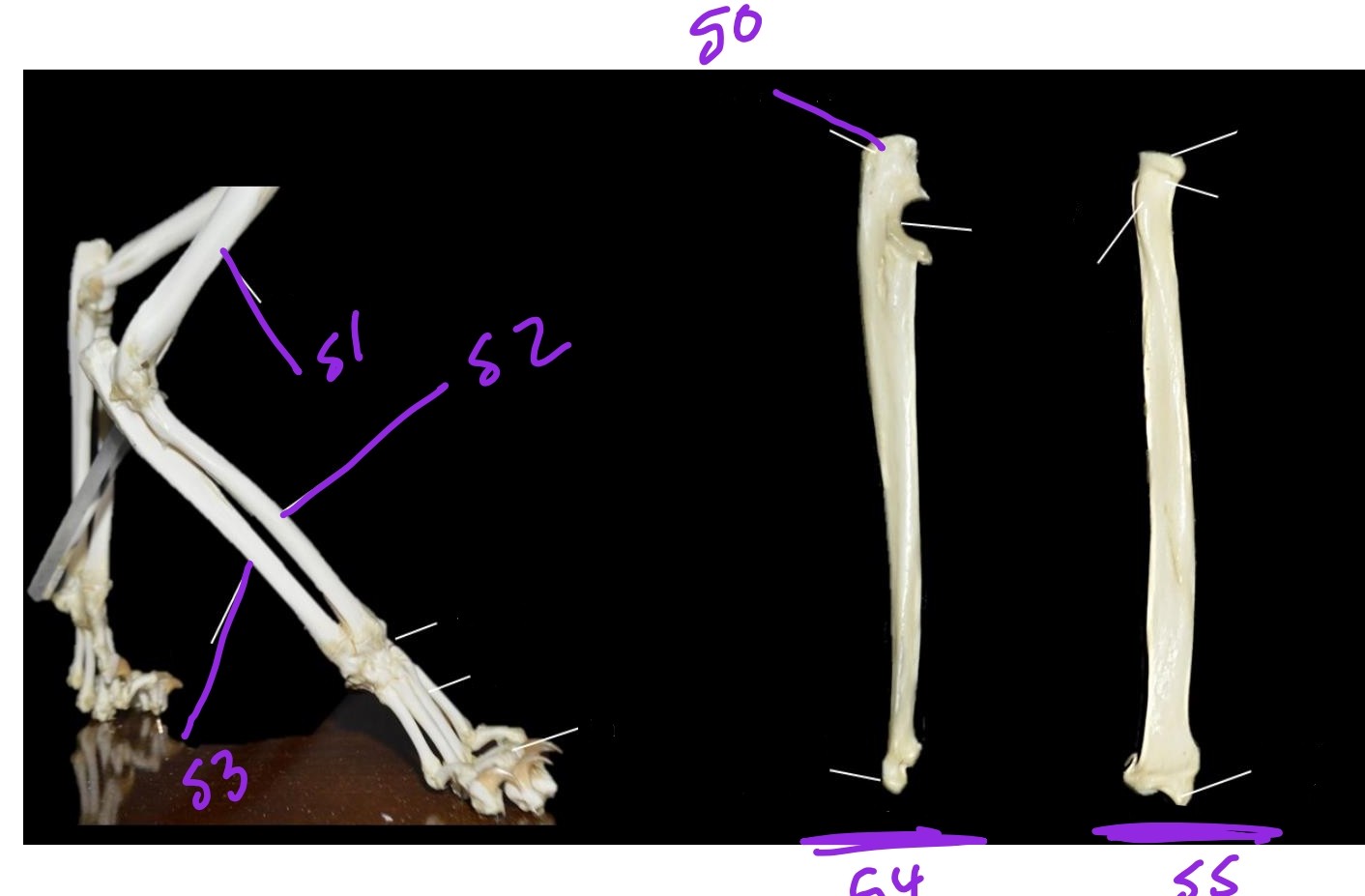 <p>50. olecranon process</p><p>51. humerus</p><p>52. radius</p><p>53. ulna</p><p>54. ulna</p><p>55. radius</p>