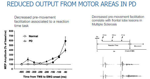 <p>There is decreased pre-movement facilitation, which affects reaction time tasks.</p><p>This results in slower initiation of movement and delayed responses during tasks requiring motor action.</p>