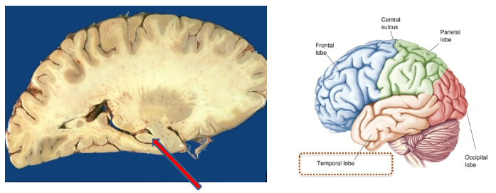 <p>Important regions within the <strong>forebrain</strong>.</p><p>Various <strong>sub-cortical structures</strong>, such as the <strong>hippocampus</strong>.</p>