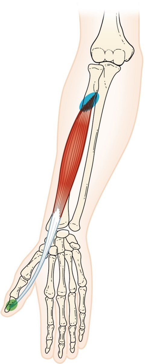 <p>Flexor Pollicis Longus</p>