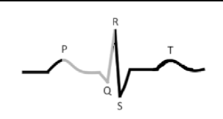 <p>what is this?</p><p>Time beginning _____ excitation to the beginning of __________ excitation</p>