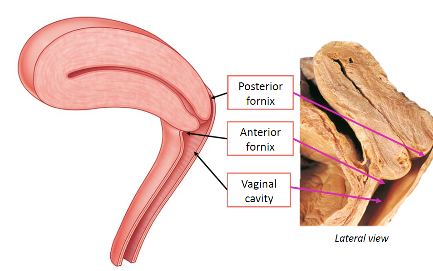 <p>The area of the vaginal lumen, particularly surrounding the cervix, is divided into four parts: anterior, posterior, and left and right lateral fornices.</p>