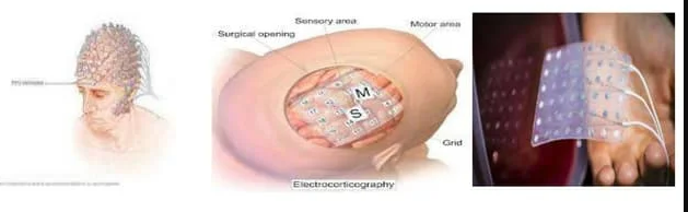 <p>electrocorticogram</p><p>signals from brain</p><p>moderately invasive- skull surgery</p><p></p><p>An electrocorticogram (ECOG) is the tracing of the brain waves made by an apparatus used for detecting and recording brain waves made with the electrodes in direct contact with the brain.</p>