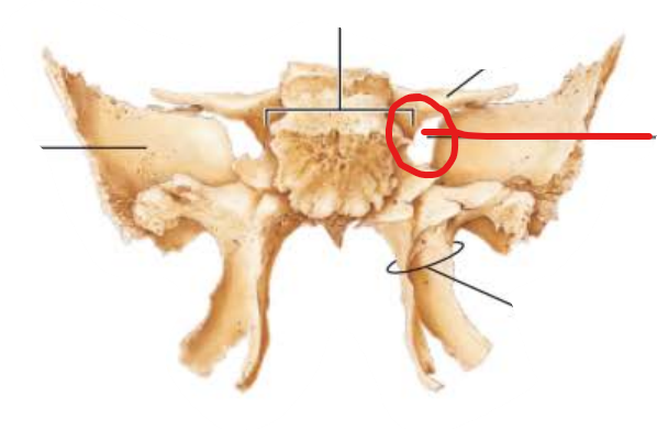 <p>Superior Orbital Fissure</p>