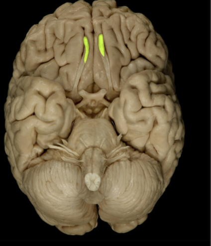 <p>Where is the Olfactory Bulb located?</p>