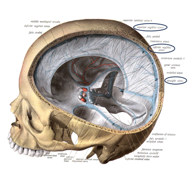 <p>The Falx Cerebri is a vertical fold of dura mater.</p><p>It is located in the <strong>median longitudinal fissure</strong>, separating the two cerebral hemispheres.</p><p>It extends from the <strong>crista galli</strong> (anteriorly) to the <strong>internal occipital protuberance</strong> (posteriorly).</p><p>Contains the <strong>superior sagittal sinus</strong> along its superior margin and the <strong>inferior sagittal sinus</strong> along its inferior margin.</p>