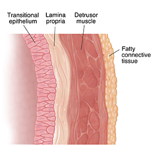 <p>✶Bladder lining: Composed of <span class="tt-bg-yellow">transitional epithelium.</span></p><p>✶Bladder muscle: Consists of the <span class="tt-bg-red">detrusor muscle</span> responsible for contraction during urination.</p><p>✶<span class="tt-bg-blue">Impermeable to salt and water</span>: Prevents the leakage of these substances into the bladder.</p><p>✶<span class="tt-bg-yellow">Permeable to lipophilic molecules</span>: Allows certain lipid-soluble substances to pass through the bladder lining.</p><p>✶<span class="tt-bg-red">Outlet of bladder into urethra</span>: Includes the internal sphincter, made of smooth muscle and under involuntary control, and the external sphincter, composed of striated muscle and under voluntary control.</p>