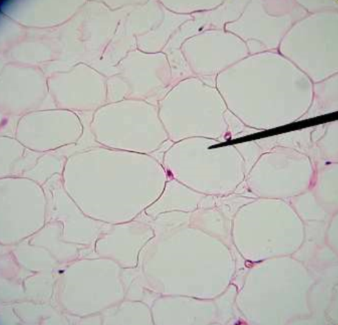 <p>What tissue type is this? and what substance is stored in the cells on this tissue?</p>