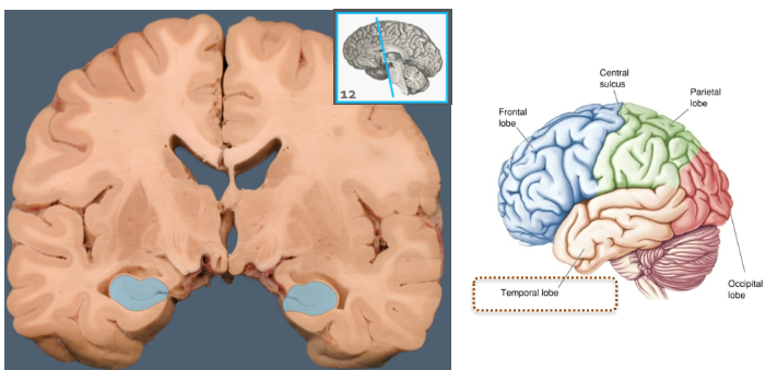 <p>Important regions within the <strong>forebrain</strong>.</p><p>Various <strong>sub-cortical structures</strong>, such as the <strong>hippocampus</strong>.</p>