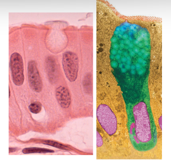 <p>What kind of gland is this?</p>