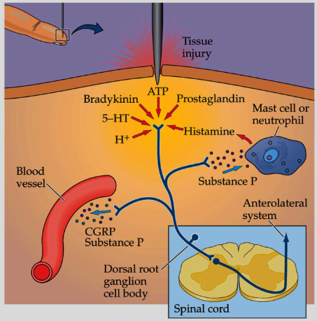 <p>An <strong>‘inflammatory soup’</strong> of cytokines, prostaglandins, and small signaling molecules.</p><p>This maintains the <strong>depolarization and sensitivity</strong> of C-fibre terminals after the original stimulus.</p>