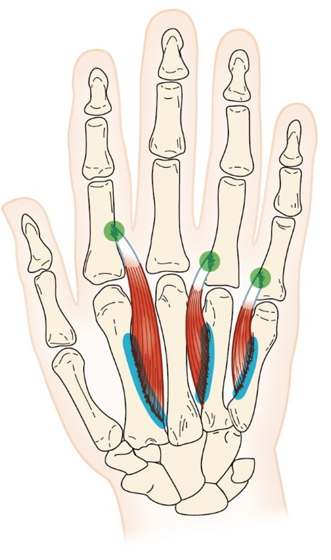 <p>Palmar Interosseus Muscles</p>