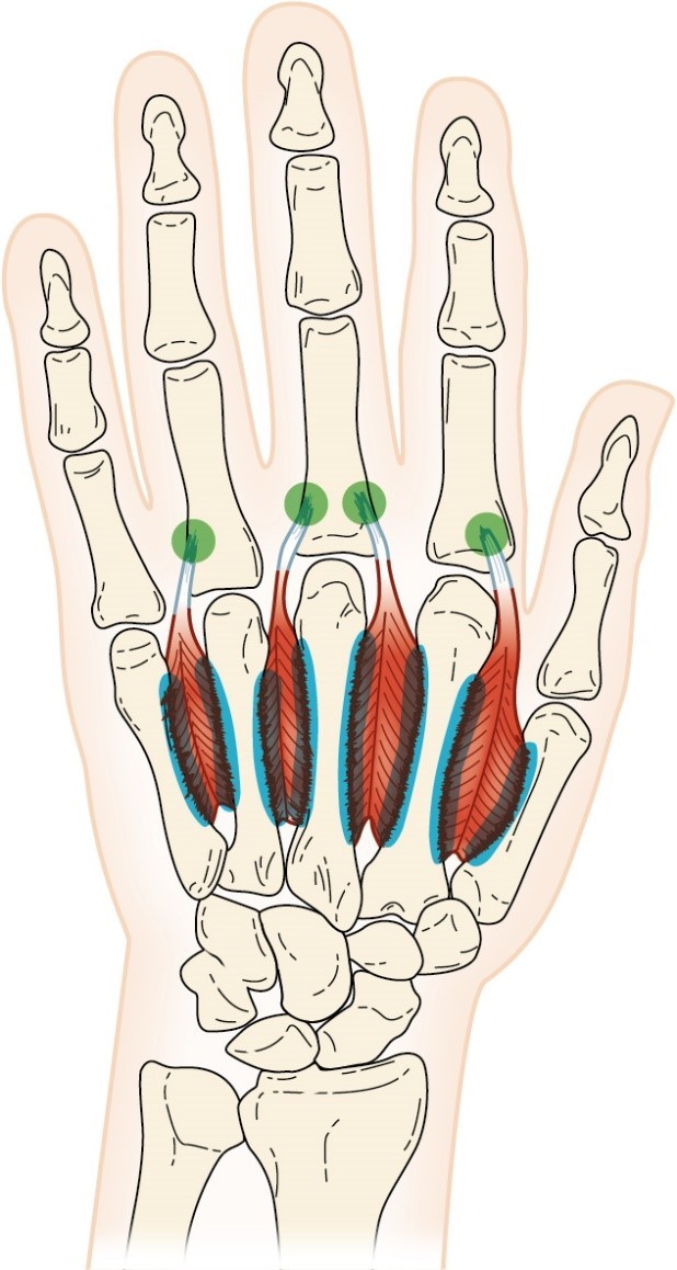 <p>Dorsal Interosseus</p>