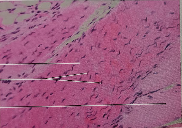 <p>Identify this tissue</p><p></p><p>Name a function</p><p></p><p>Name a specific place where it is found</p>