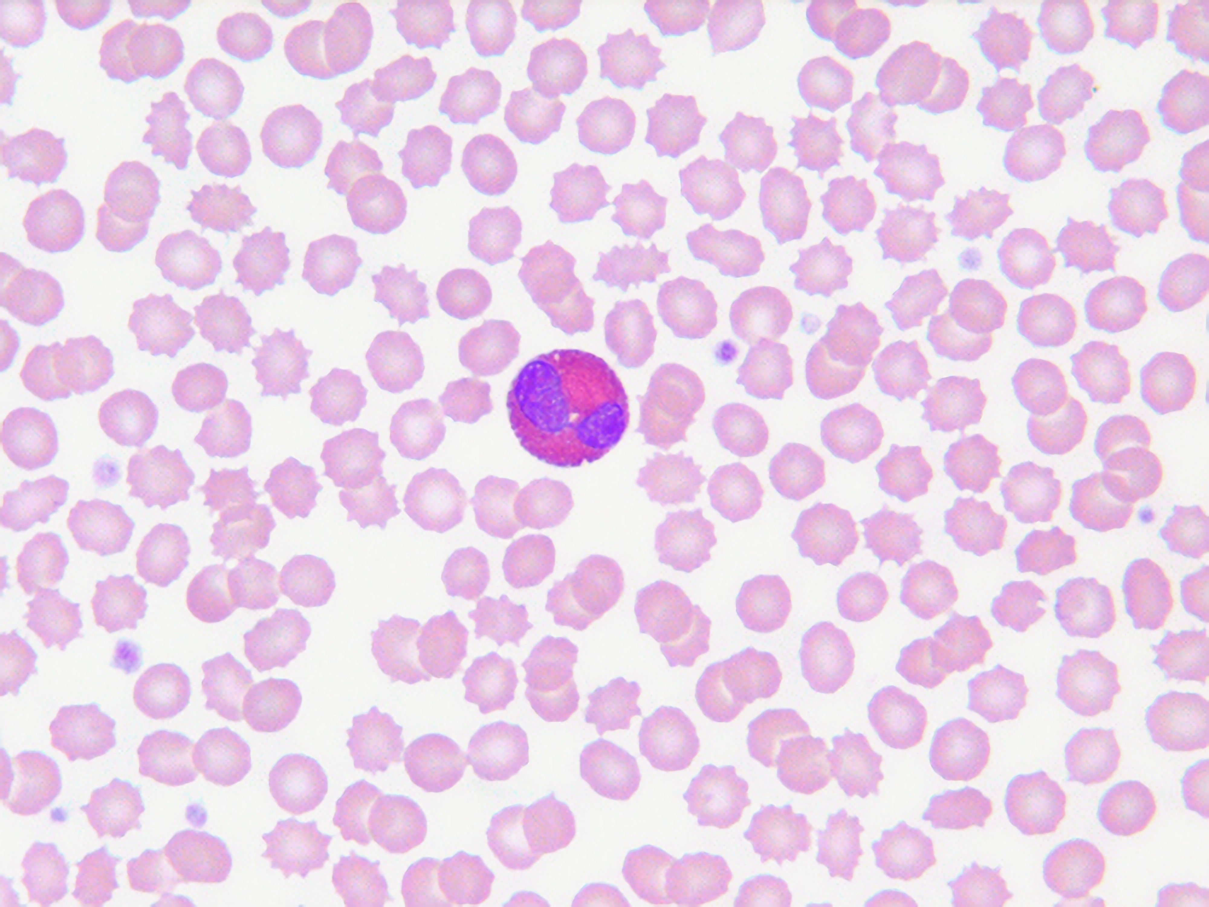 <p>-Cytoplasmic granules stain red with eosin</p><p>-Generally have two-lobed nucleus</p>
